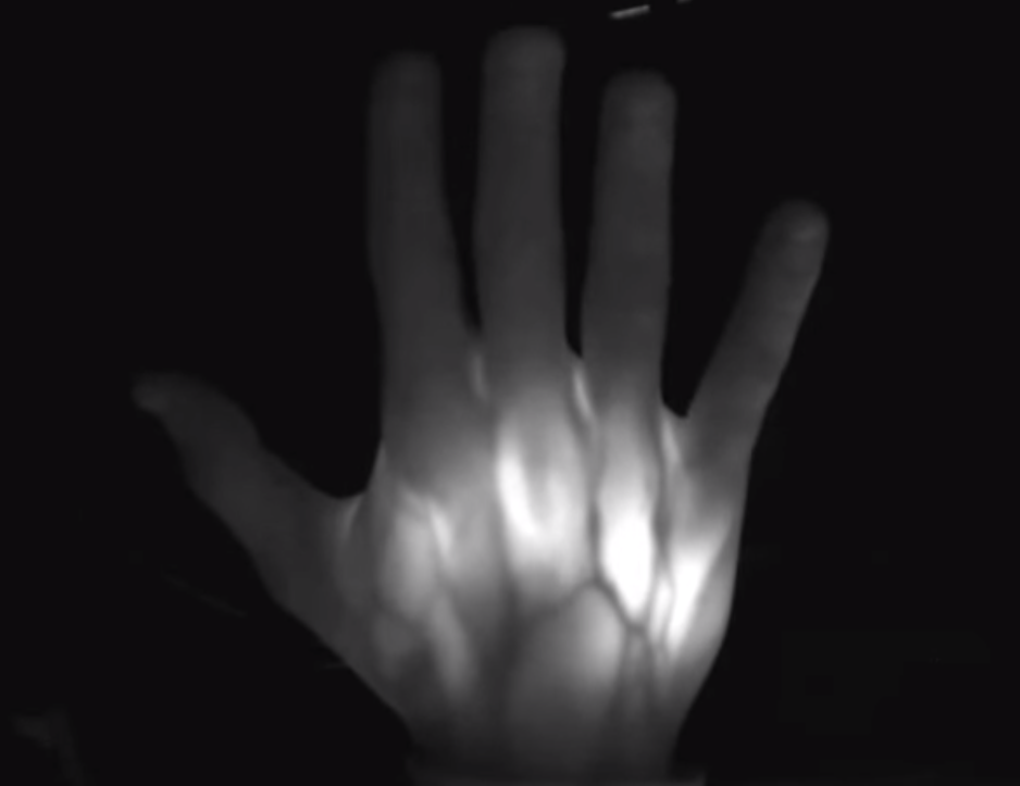 Tecnologia para monitoramento e controle da higienização das mãos
